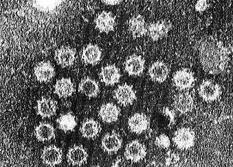 ノロウイルス電子顕微鏡写真と歴史